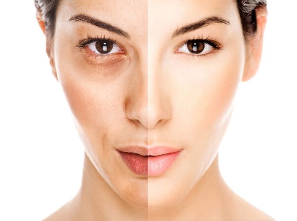 The anti-aging effect of Coralift cream