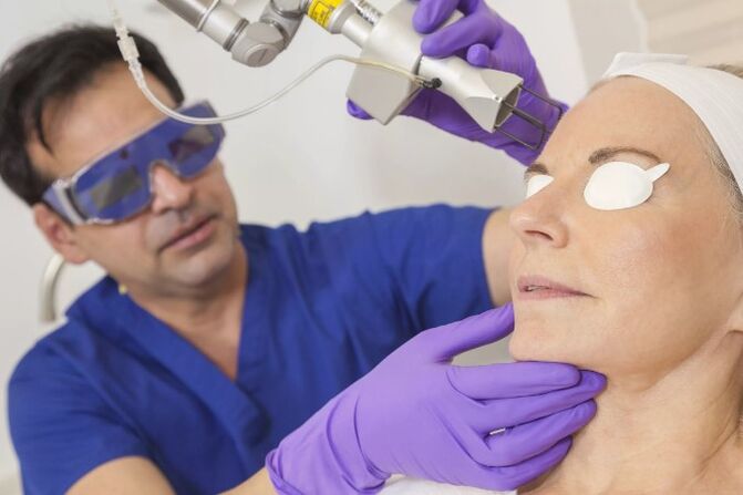 Skin rejuvenation with laser