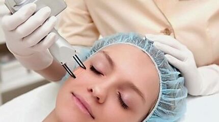 Laser facial rejuvenation